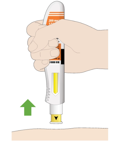 remove pen from skin